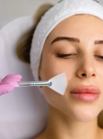 Understanding-Chemical-Peels-Duration-Benefits-and-Care-female-getting-chemical-peel-facial-treatment-1024x682
