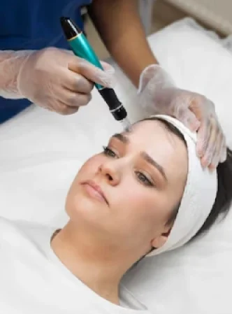 face-laser-overview-1